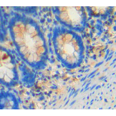 Feline Sarcoma Oncogene (FES) Human Polyclonal Antibody