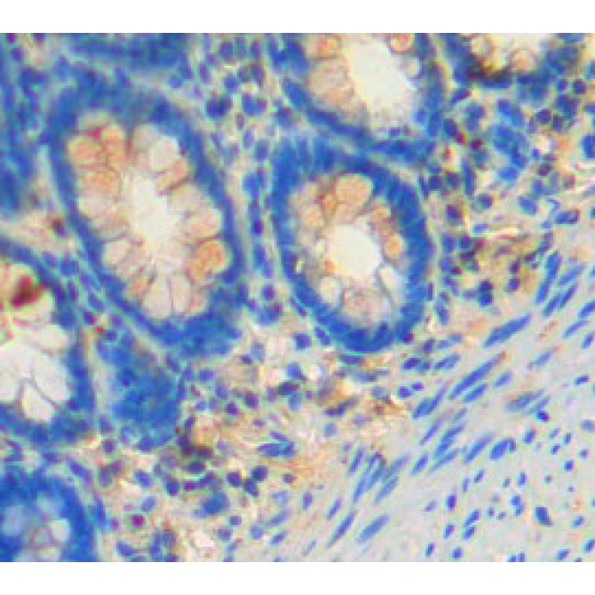 Feline Sarcoma Oncogene (FES) Human Polyclonal Antibody