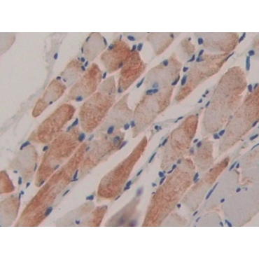 Feline Sarcoma Oncogene (FES) Mouse Polyclonal Antibody