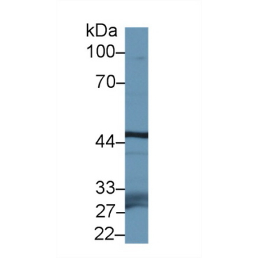 F-Box And Leucine Rich Repeat Protein 3 (FBXL3) Mouse Polyclonal Antibody