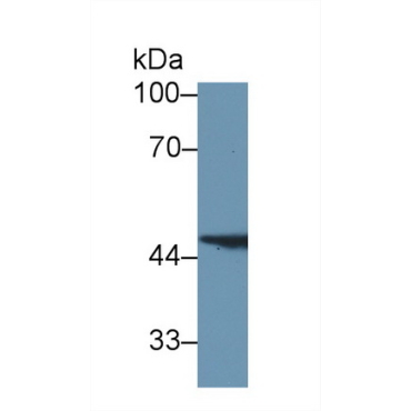 Fumarylacetoacetate Hydrolase (FAH) Human Polyclonal Antibody