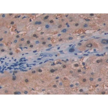 Fumarylacetoacetate Hydrolase (FAH) Human Polyclonal Antibody