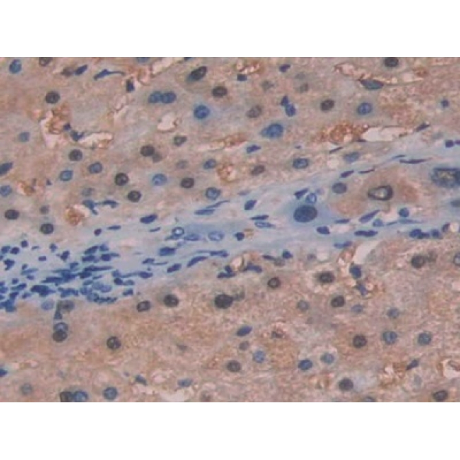 Fumarylacetoacetate Hydrolase (FAH) Human Polyclonal Antibody