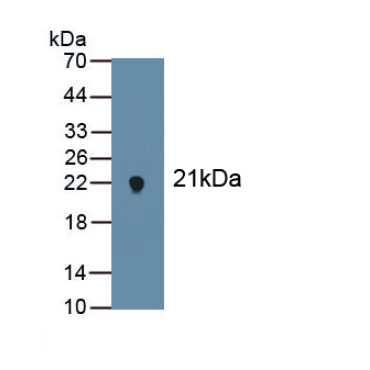 Eosinophil Peroxidase (EPX) Human Polyclonal Antibody