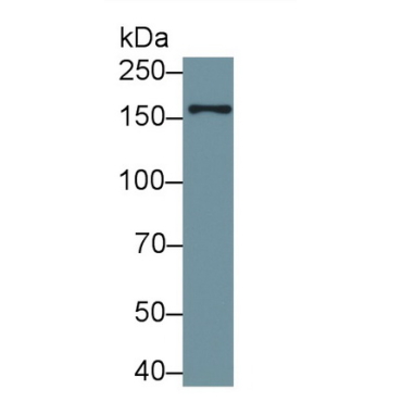 Early Endosome Antigen 1 (EEA1) Human Polyclonal Antibody