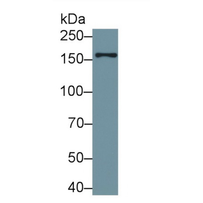 Early Endosome Antigen 1 (EEA1) Human Polyclonal Antibody
