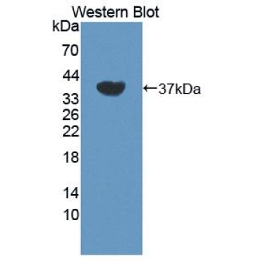 Dual Specificity Tyrosine Phosphorylation Regulated Kinase 1A (DYRK1A) Human Polyclonal Antibody