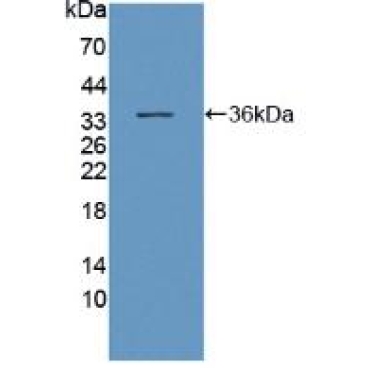 Dynein, Axonemal, Heavy Chain 11 (DNAH11) Human Polyclonal Antibody