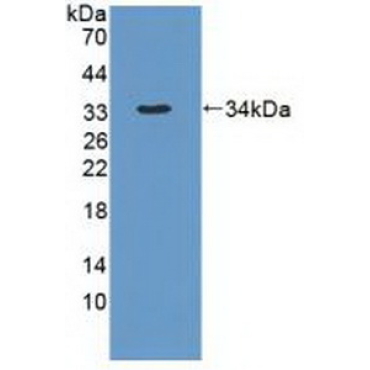 Dynein, Cytoplasmic 1, Heavy Chain 1 (DYNC1H1) Human Polyclonal Antibody
