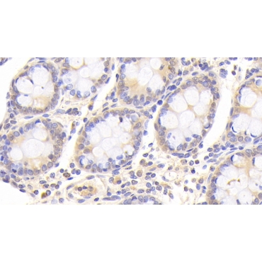Destrin (DSTN) Human Polyclonal Antibody