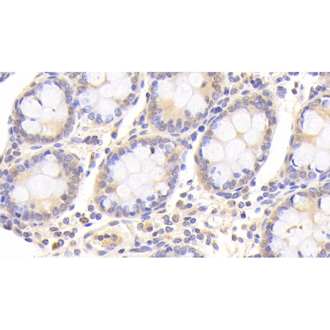 Destrin (DSTN) Human Polyclonal Antibody