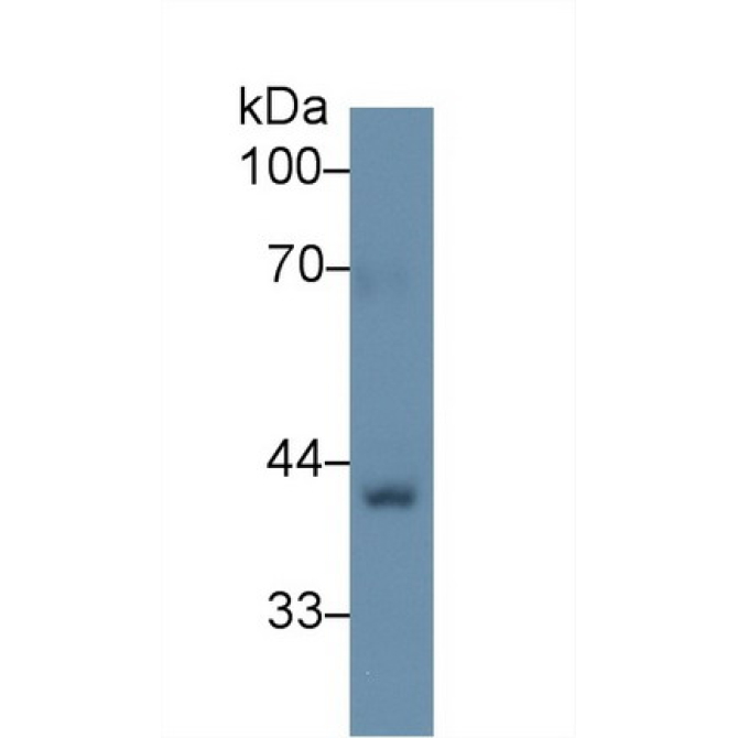 Biglycan (BGN) Human Polyclonal Antibody