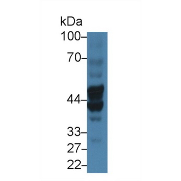 Biglycan (BGN) Human Polyclonal Antibody