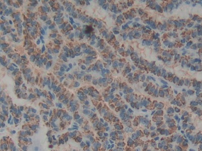 Biglycan (BGN) Rat Polyclonal Antibody