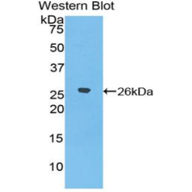 Epiphycan (EPYC) Human Polyclonal Antibody