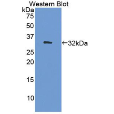 DNA Methyltransferase 1 (DNMT1) Human Polyclonal Antibody