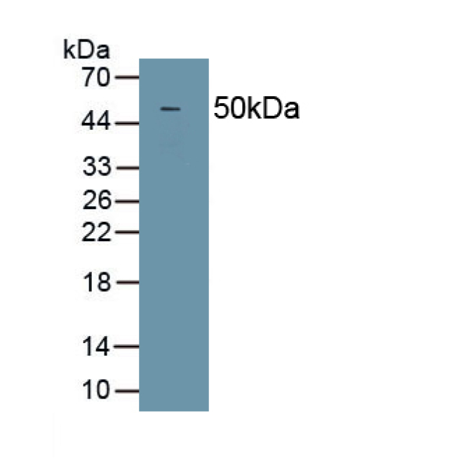 Deleted In Malignant Brain Tumors 1 (DMBT1) Human Polyclonal Antibody