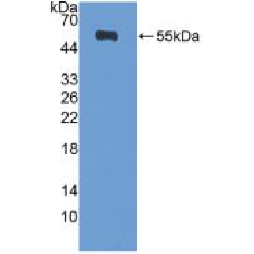 Diaphanous Homolog 1 (DIAPH1) Human Polyclonal Antibody