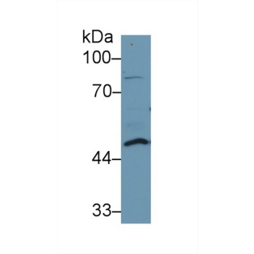 Dolichyl Diphosphooligosaccharide Protein Glycosyltransferase (DDOST) Human Polyclonal Antibody