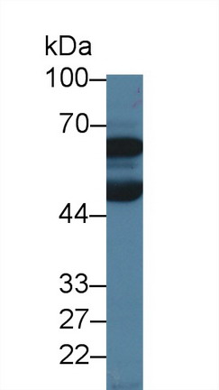 Debranching Enzyme Homolog 1 (DBR1) Human Polyclonal Antibody