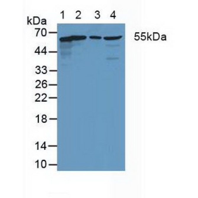 Coxsackie Virus And Adenovirus Receptor (CXADR) Human Polyclonal Antibody