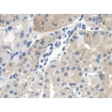 Di-N-Acetyl Chitobiase (CTBS) Human Polyclonal Antibody