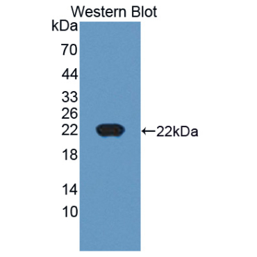 Cancer/Testis Antigen 1B (CTAG1B) Human Polyclonal Antibody