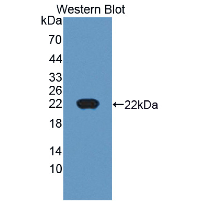 Cancer/Testis Antigen 1B (CTAG1B) Human Polyclonal Antibody