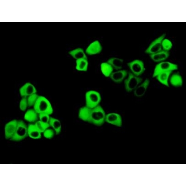 Cystatin B (CSTB) Human Polyclonal Antibody