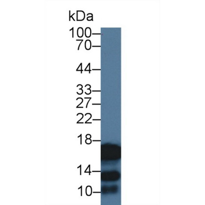 Cystatin 2 (CST2) Human Polyclonal Antibody