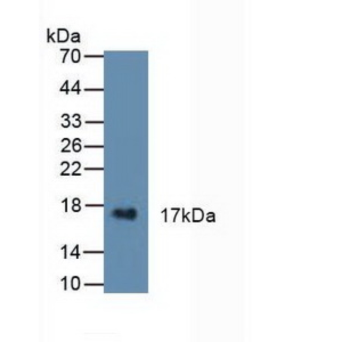 Cystatin 6 (CST6) Human Polyclonal Antibody