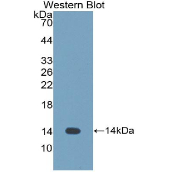 Cystatin 1 (CST1) Human Polyclonal Antibody