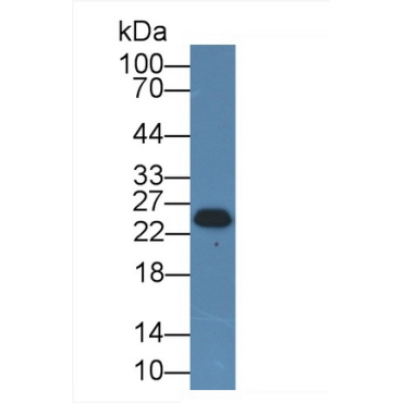 Casein Beta (CSN2) Human Polyclonal Antibody