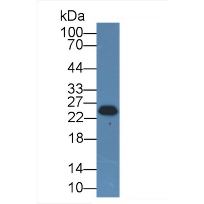 Casein Beta (CSN2) Human Polyclonal Antibody