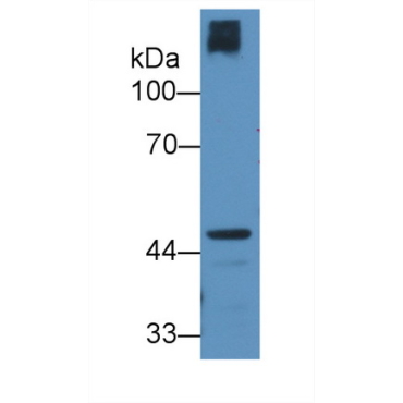 Cartilage Associated Protein (CRTAP) Mouse Polyclonal Antibody