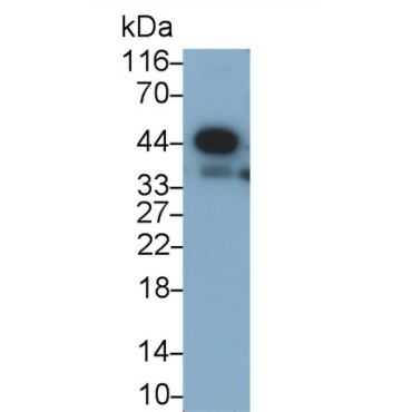 Cysteine Rich With EGF Like Domains Protein 1 (CRELD1) Human Polyclonal Antibody
