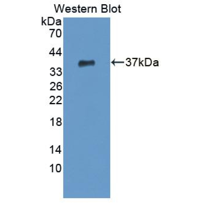 Cleavage And Polyadenylation Specific Factor 1 (CPSF1) Human Polyclonal Antibody