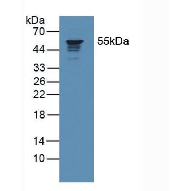 Coronin 1A (CORO1A) Human Polyclonal Antibody