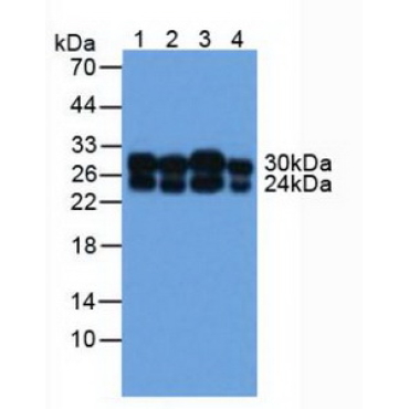 Catechol-O-Methyltransferase (COMT) Human Polyclonal Antibody