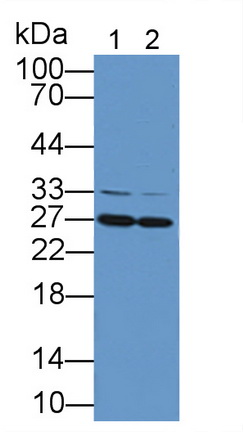 Catechol-O-Methyltransferase (COMT) Rat Polyclonal Antibody