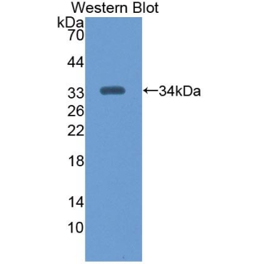 Chitinase 1 (CHIT1) Human Polyclonal Antibody
