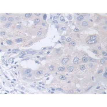 Chitinase 3 Like Protein 2 (CHI3L2) Human Polyclonal Antibody