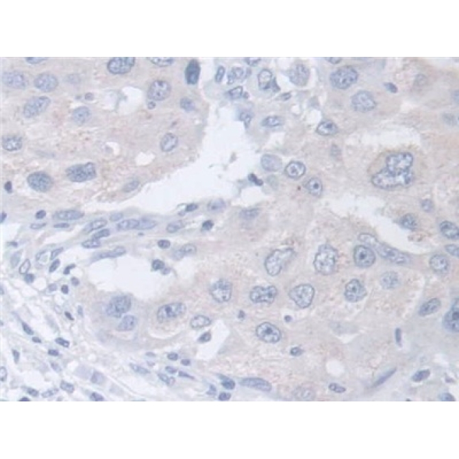 Chitinase 3 Like Protein 2 (CHI3L2) Human Polyclonal Antibody