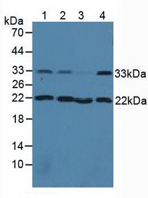 Calponin 2 (CNN2) Human Polyclonal Antibody