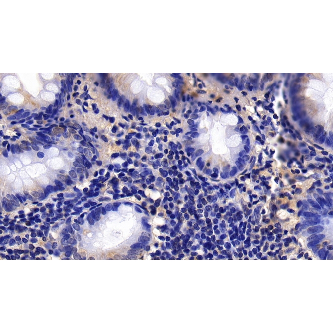 Calponin 1, Basic (CNN1) Human Polyclonal Antibody