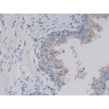 Lactamase Beta (LACTb) Human Polyclonal Antibody