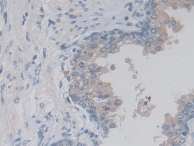 Lactamase Beta (LACTb) Human Polyclonal Antibody