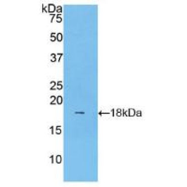 Lecithin Cholesterol Acyltransferase (LCAT) Human Polyclonal Antibody