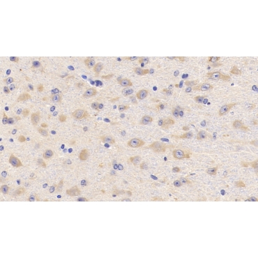 Lecithin Cholesterol Acyltransferase (LCAT) Mouse Polyclonal Antibody