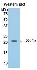 Lecithin Cholesterol Acyltransferase (LCAT) Rat Polyclonal Antibody